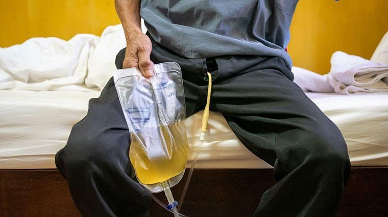 Catheter-Associated Urinary Tract Infections & Sepsis - QuickChange Incontinence Wrap - UK