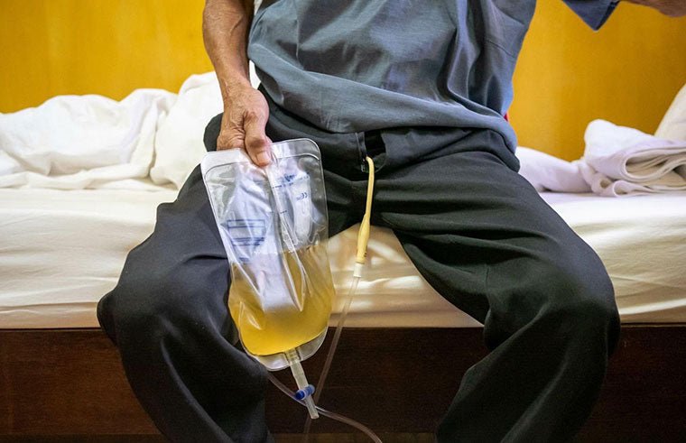 Catheter-Associated Urinary Tract Infections & Sepsis - QuickChange Incontinence Wrap - UK